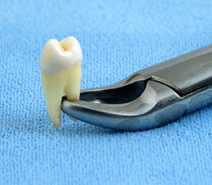 Root canal treatment during chemotherapy