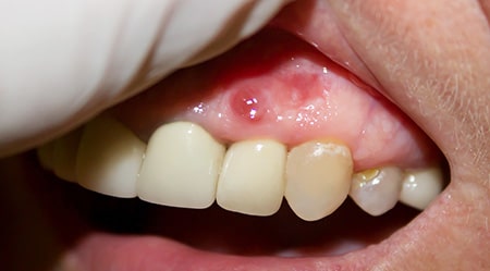 Common Dental Problems & Oral Diseases - Carson & Carson, Dds