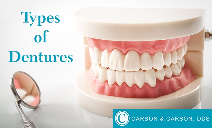 Types of Dentures - Oxnard Dentist - Carson & Carson, DDS